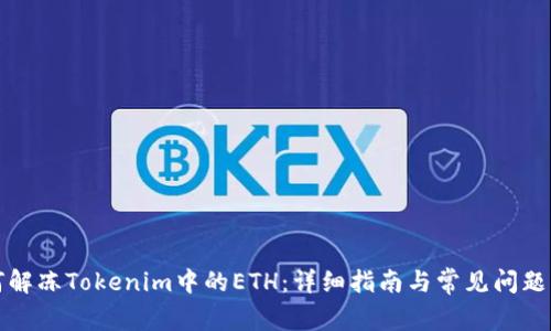 如何解冻Tokenim中的ETH:详细指南与常见问题解答